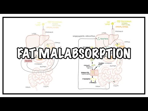 Approach to Fat malabsorption - signs and symptoms and causes