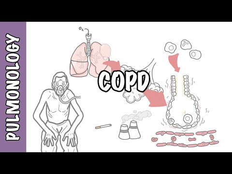 Understanding COPD - Chronic obstructive pulmonary disease cause, pathophysiology and treatment