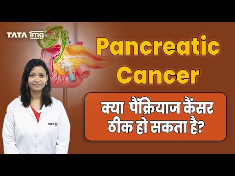 Commonly asked questions about Pancreatic cancer