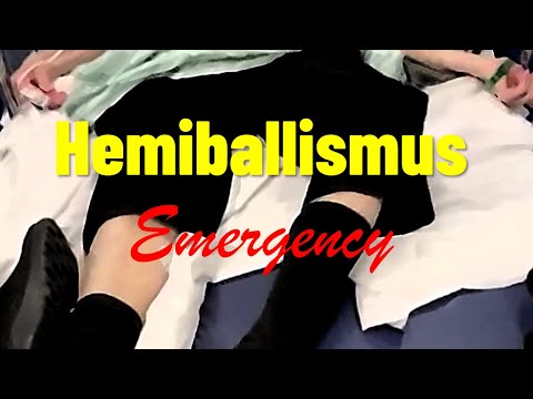 Hemiballismus Emergency