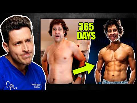 Doctor Reacts To David Dobrik's Weight Loss