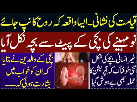 9 Mah Ki Bachi Kay Pait Say Aik Or Bacha Nikal aaya ? Sadqabaad ka Waqiya | Qamar Sohail vlogs|