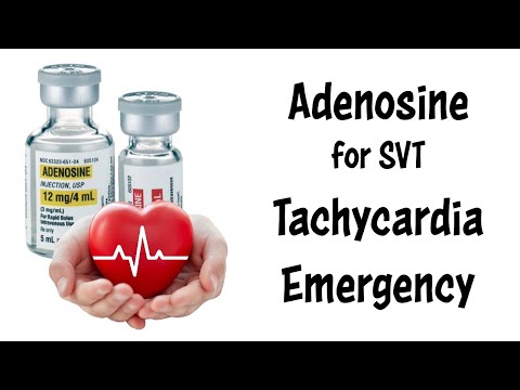 Treating Supraventricular Tachycardia (SVT) with Adenosine