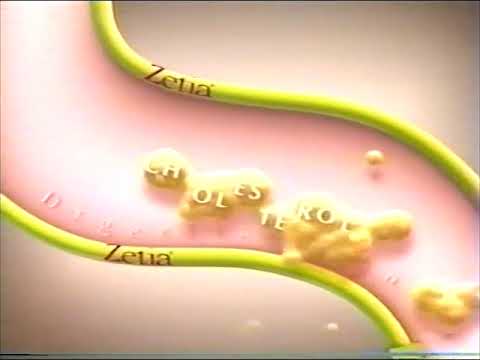 2006 Zetia Cholestorol Medication Commercial