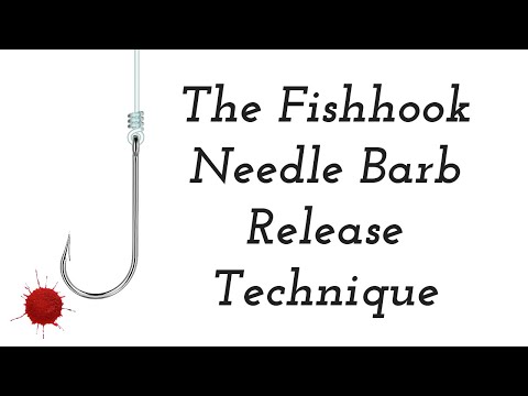 The Fishhook Needle Barb Release Technique