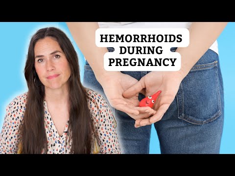 Hemorrhoids During Pregnancy 🚨 Natural Remedies