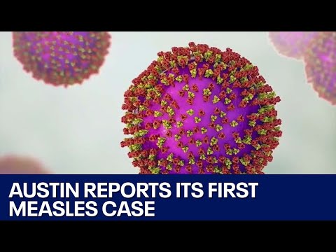 Measles: Infant in Austin tests positive for virus | FOX 7 Austin