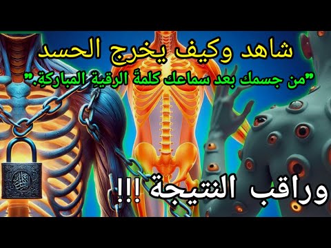 الرقية الشرعية الصوتية لعلاج السحر والمس,Syech Ayoub Mossab