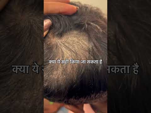 Book Your Appointment hair related problem