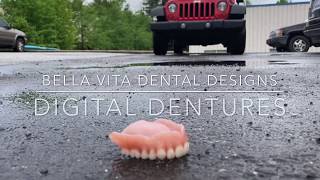 Bella Vita Dental Designs runs over Digital Denture with JEEP!