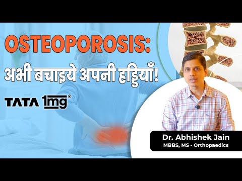 Osteoporosis: Aapki Haddi ka Silent Killer! | Prevention Tips