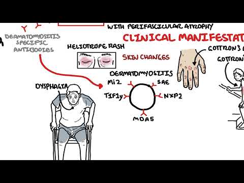 Dermatomyositis Overview