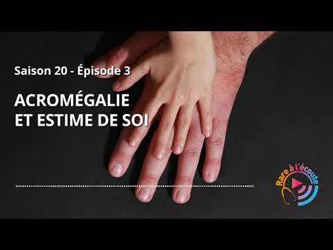 Acromégalie et estime de soi