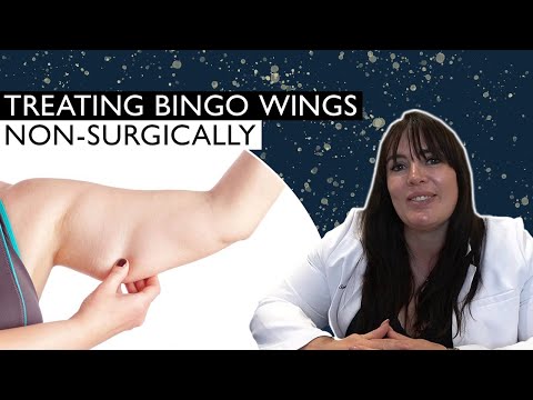 How to Treat Bingo Wings Non-Surgically