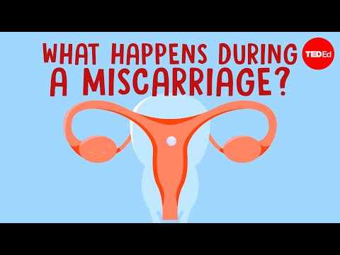 What happens in your body during a miscarriage? - Nassim Assefi and Emily M. Godfrey