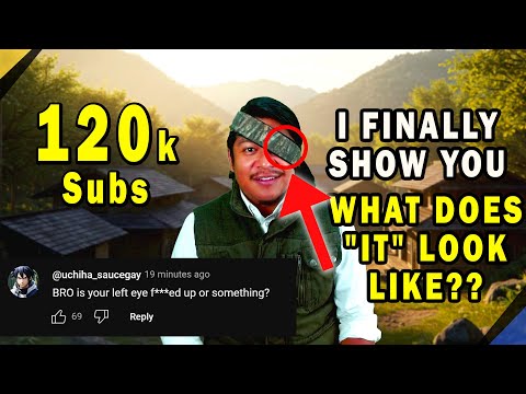 120k Subs special! Left Eye Reveal. FINALLY.