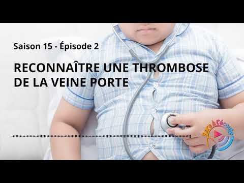 Reconnaître une thrombose de la veine porte