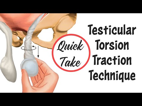 Testicular Torsion Traction Technique Quick Take