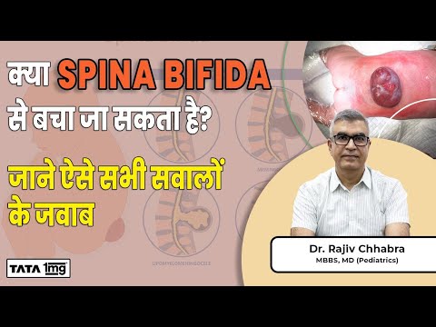 क्या Spina Bifida (स्पाइना बिफिडा ) से बचा जा सकता है? जाने ऐसे सभी सवालों के जवाब | Dr Rajiv | 1MG