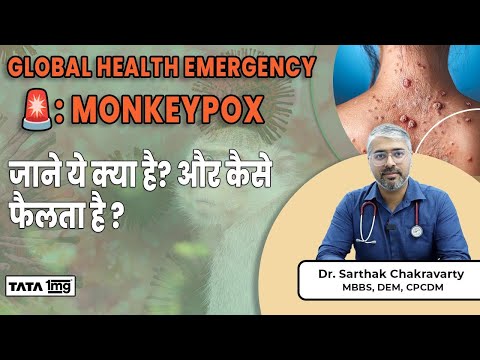 MONKEYPOX जाने ये क्या है? और कैसे फैलता है? | MPOX Virus in India | Causes and Symptoms |Dr Sarthak