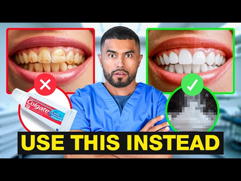 How To Fix Your Teeth (Use At Home Products)