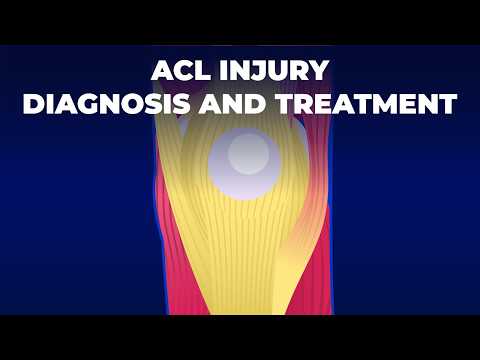 How Does ACL Injury Happens and What can You Do