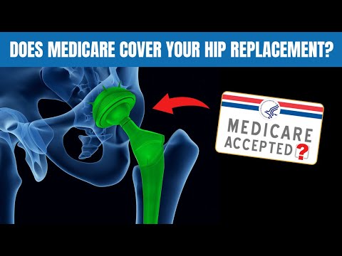 Does Medicare Cover Total Hip Replacement Surgery?