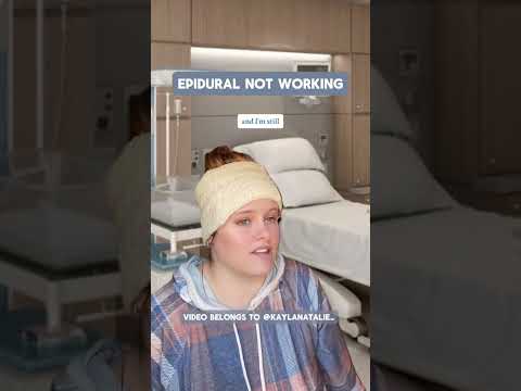 Epidural not working