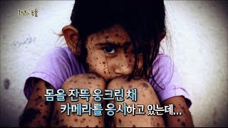 [서프라이즈] 온몸이 점과 털로 뒤덮힌 소녀, 마을에 이상한 일이 일어나고있다