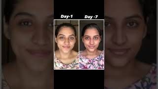 Garnier Vitamin C Serum Review| 3 Day Challenge Review| #shorts #youtubeindia