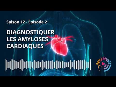 Diagnostiquer les Amyloses Cardiaques