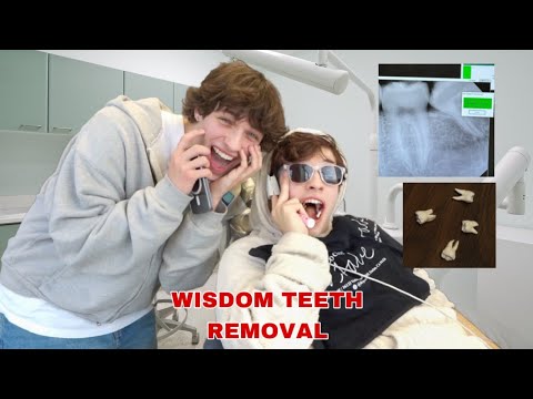 NICK GETS HIS WISDOM TEETH REMOVED!!