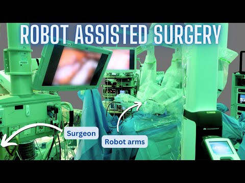 How robot assisted surgery works (as explained by a surgeon)