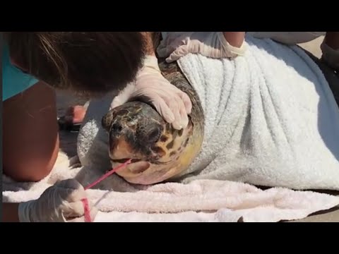 SEATURTLE gets rescued after SWALLOWING fishing NET in Greece|#shorts