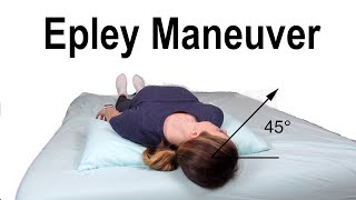 Epley Maneuver to Treat BPPV Dizziness