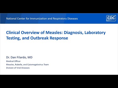 Clinical Overview of Measles: Diagnosis, Laboratory Testing and Outbreak Response