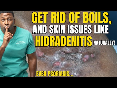 How To Get Rid of Hidradenitis Suppurativa Or Any Skin Condition PERMANENTLY!