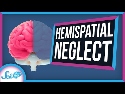 Hemispatial Neglect: When Half Your World Disappears