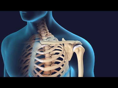 Reverse Shoulder Replacement Surgery