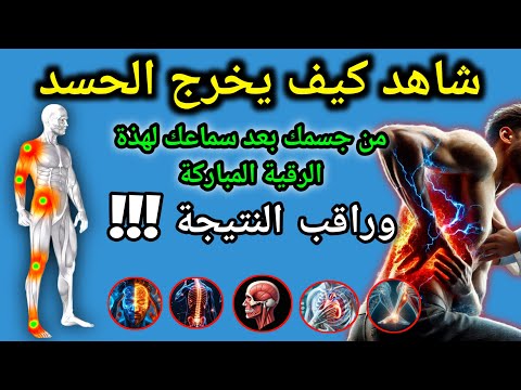 رُقْيَة شرعية شاملة للشفاء من الأمراض | آيات الشفاء وعلاج الحسد والعين,aqel