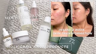 my *holy grail* korean skincare for calming acne & healing my skin barrier | ANUA product review