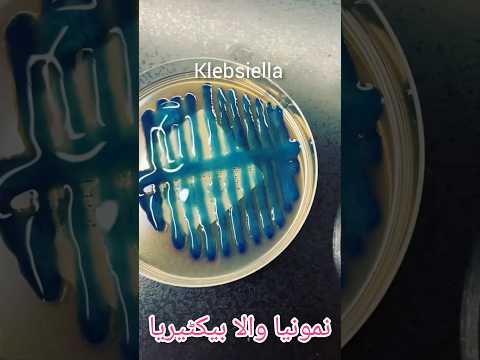 Klebsiella (the king ) | Klebsiella pneumoniae