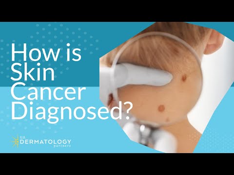 How is Skin Cancer Diagnosed?