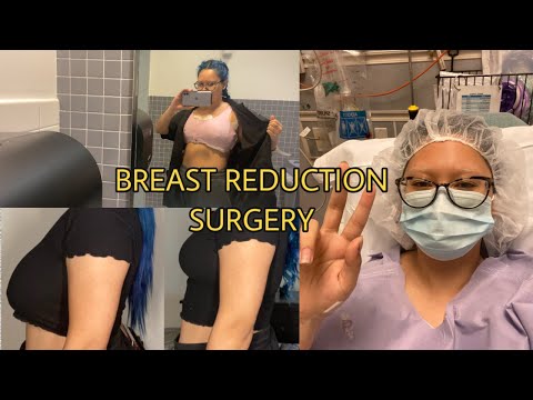 GETTING A BREAST REDUCTION DURING A PANDEMIC VLOG 38G-38C | Jada Desiree