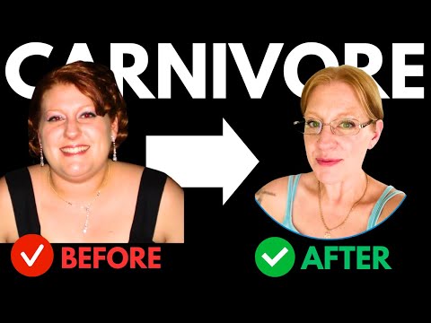 Nurse Transformed Her Body and LIFE, Here’s How She Did It on Carnivore