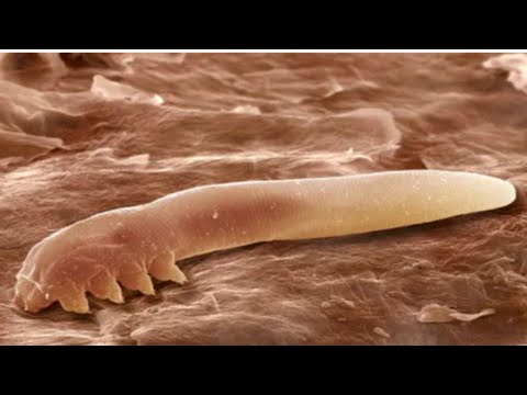 حشرة مجهرية حقيقية تحتل وجهك  و اسمها عثه الوجه أو Demodex