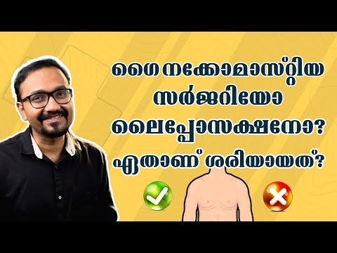 ഗൈനക്കോമാസ്റ്റിയ സർജറിയോ ലൈപ്പോസക്ഷനോ? ഏതാണ് ശരിയായത്? | Mykare Health