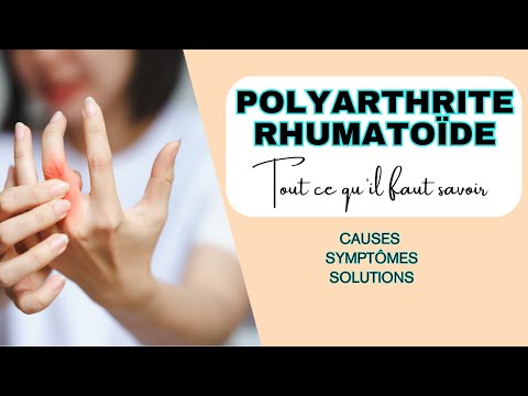 Polyarthrite rhumatoïde, tout ce qu'il faut savoir (causes, symptômes, solutions)