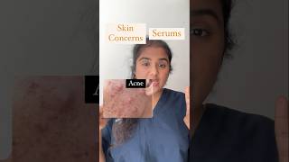 Skin problems- serums -serums for acne , oilyskin, hyperpigmentation,anti aging serums -best serums