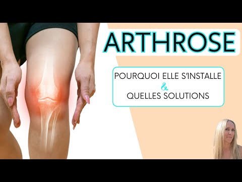 Arthrose : causes et solutions naturelles